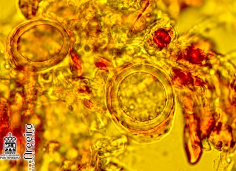 Oosporas (ovos de inverno) vistas ao microscopio