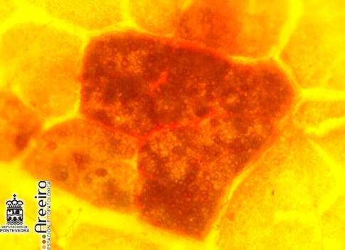 Detalle das oosporas nunha mancha en mosaico (vistas  lupa)